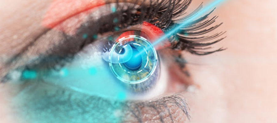 WHY LASIK EYE SUGERY?